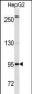 CD19 Antibody (C-term) (Ascites)